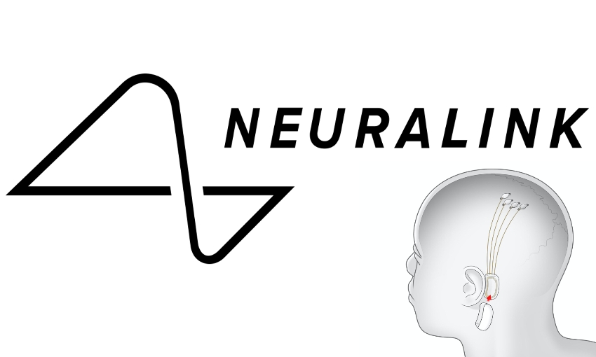 Neuralink